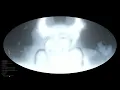 FISHER, AATIG - TAKE IT OFF (frosttop edit)