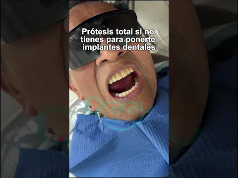 Prótesis completa #protesisdental