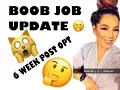 BOOB JOB UPDATE 6 WEEK POST OPT