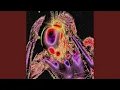 Download Lagu I JUST NEED MORE (feat. Fuze \u0026 Sam West)
