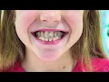 Nastya learns how important it is for children to wear braces