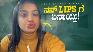 nan lips ge en aythu lip correction vlog sonu srinivas gowda kannada vlog 