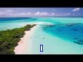 Patoranking - This Kind Love [Official Video] ft. WizKid