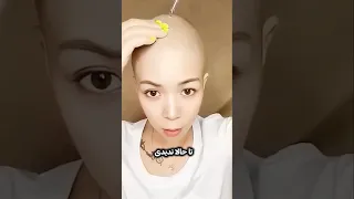 اگه ریزش مو داری این ویدیو را حتما ببین 