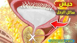 شاهد ما يحدث عند حبس سائل الرجل محتوي طبي تثقيفي 