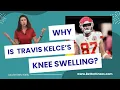 Why is Travis Kelce s knee swelling And how his injury can help your knees
