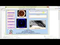Iris Recognition Using Image Processing Full Matlab Project with Source Code