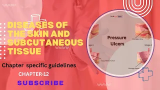 ICD-10CM CHAPTER-12 DISEASES OF THE SKIN SUBCUTANEOUS TISSUE