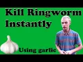 Kill Ringworm Instantly Using Garlic