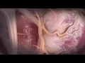 CSI - ViperWire