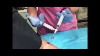 Agitated Saline Bubble Study