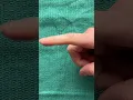 Finger Reduction