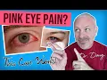 PINK EYE CURE Dr Doug