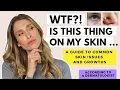 A Dermatologist s Guide to Skin Growths Dr Sam Ellis