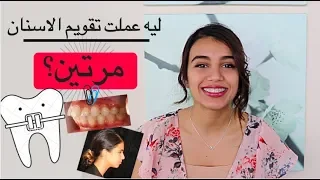 تقويم الاسنان تجربتي مع تقويم الاسنان خلع الاسنان و أسعار التقويم  تقويم الاسنان تجربتي مع تقويم الاسنان خلع الاسنان و أسعار التقويم