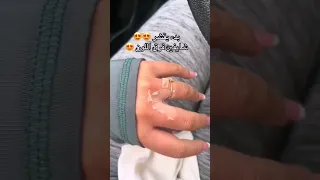 تقشير كيميائي  مقشر جنات احماض الفواكه  تقشير كيميائي  تقشير دندنها