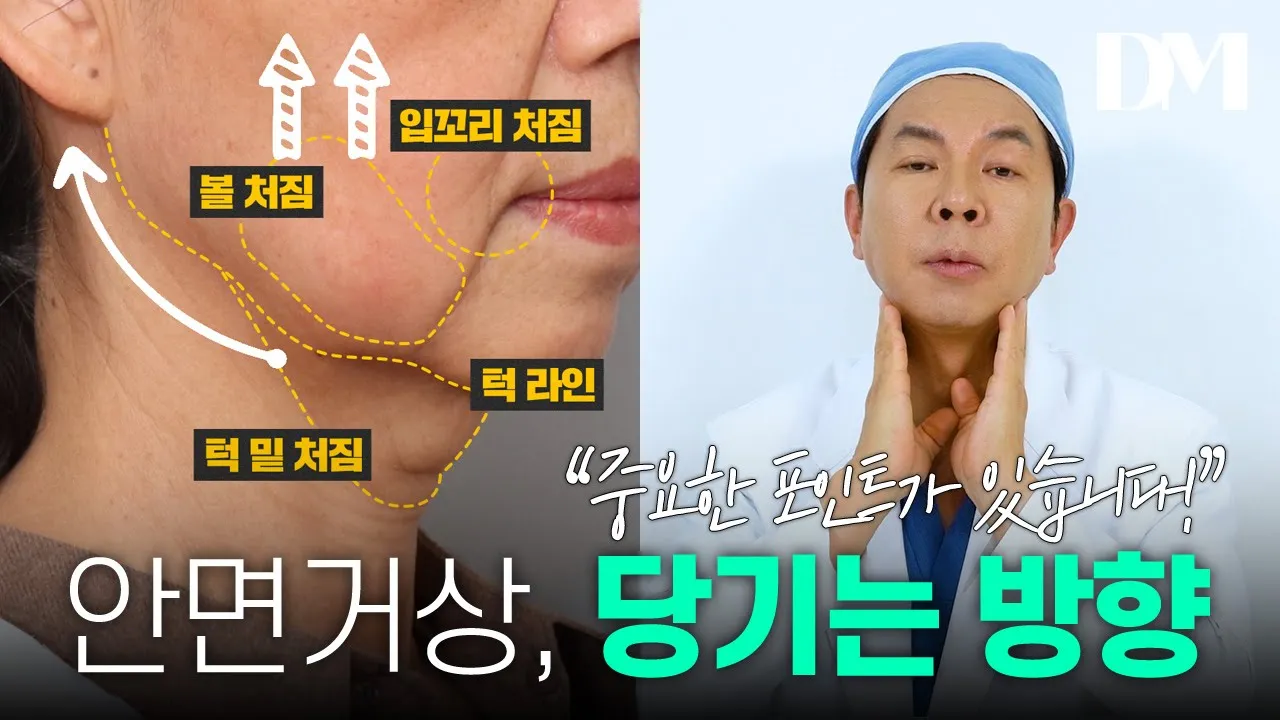 안면거상, 당기는 방향에 따라 효과가 다르다?🤔 #안면거상 #동안성형 #리프팅