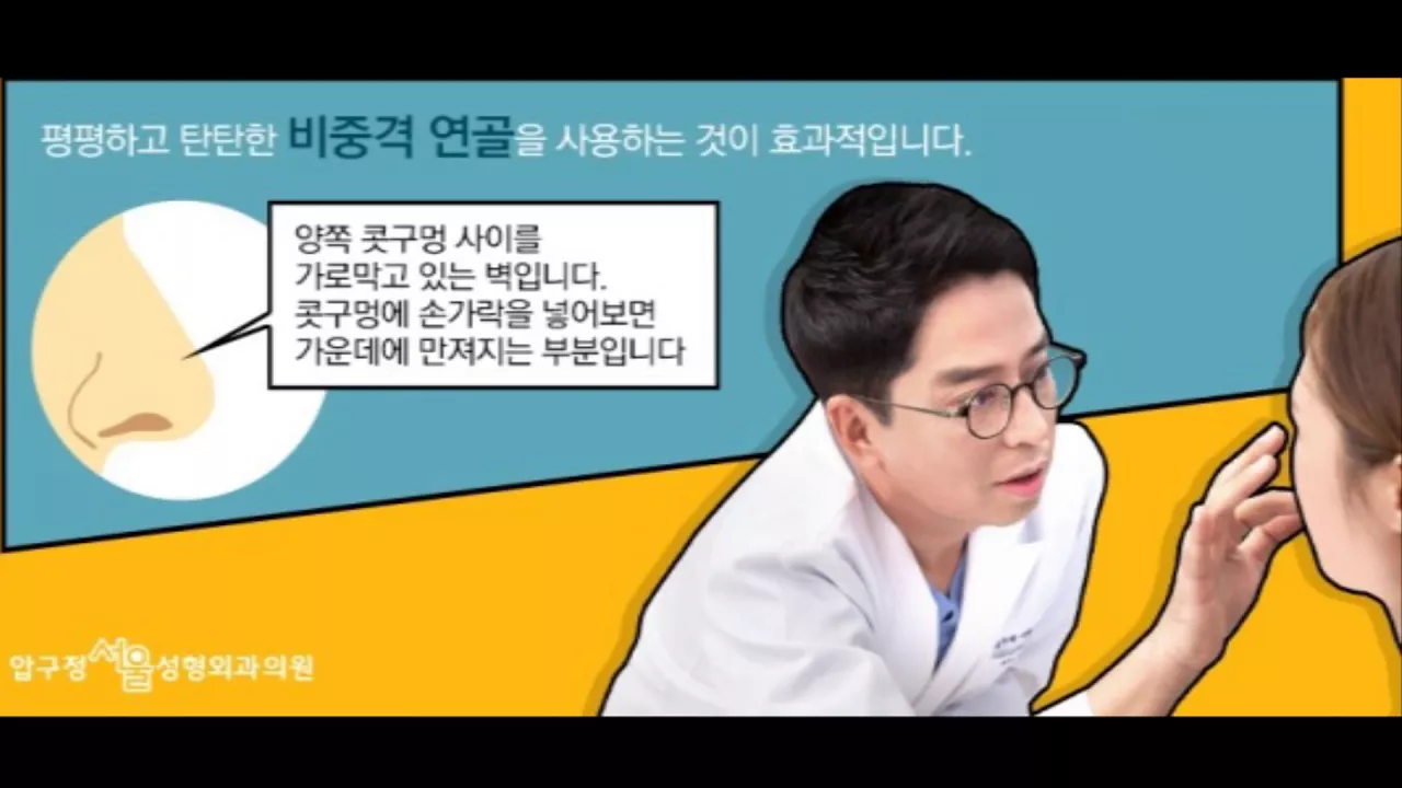 코수술이 궁금하다면? 압구정서울 웹툰 영상