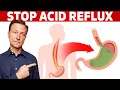 How to STOP Acid Reflux Instantly