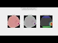 Malaria Detection using Deep Learning