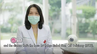 ผิวดวงตาคืออะไร และมีหน้าที่อย่างไรต่อการมองเห็น