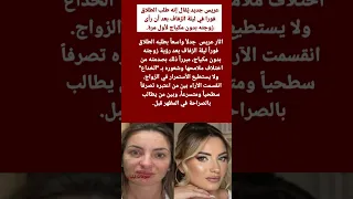 عريس جديد ي قال إنه طلب الطلاق فورا في ليلة الزفاف بعد أن رأى زوجته بدون مكياج لأول مرة  دندنها