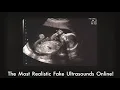 Fake Ultrasounds Online