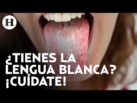 Download MP3 ¡Problemas del hígado e intestinales! Si tienes la lengua blanca, esto te interesa