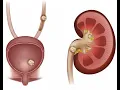 Urography CPT code - simplify medical coding