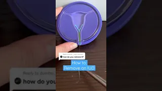Ever wonder how we remove an IUD Here you go