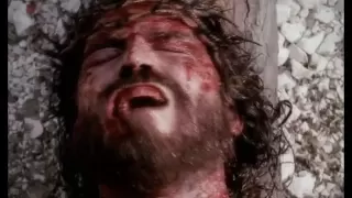 زياد شحاته يدك المثقوبة 