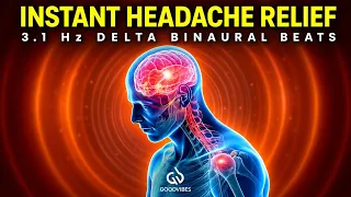 Instant Headache Relief: 3.1 Hz Delta Binaural Beats, Heal Headache ASAP