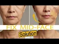 Download Lagu Mid Face Exercise to Tighten \u0026 Tone Your Skin Fast !