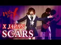 Download Lagu 【女性が歌う】SCARS / X JAPAN (key+4) Cover by MINT SPEC