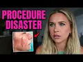 procedures i ve had done and the disaster that followed
