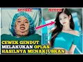 Cewek Gendut Ini Melakukan OPLAS Karena Sering Diejek - Alur Cerita Film 200 Pounds Beauty