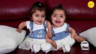 The 6-Year-Old Twins Everyone Mistakes for Babies (Brittle Bone Disease)