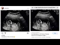 Liv s life Fake baby Fake ultrasound Smh Come on now sis this is beyond crazy