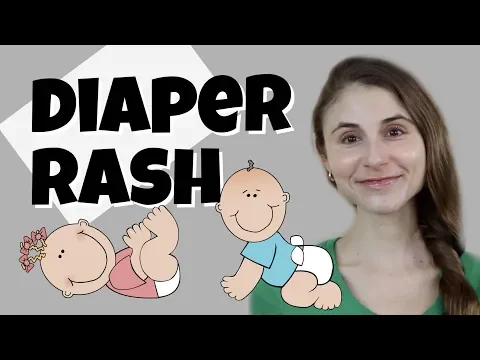 Download MP3 DIAPER RASH TIPS \u0026 TRICKS FROM A DERMATOLOGIST| DR DRAY