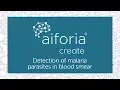 Aiforia Create - Detection of Malaria Parasites in Blood Smear