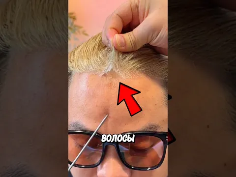 Опасная Болезнь Волос! 😱