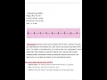 Relias Dysrhythmia Basic A Assessment Test Latest 2025 2026 Most Comprehensive to Pass the Exam 1