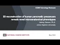 3D reconstruction of human pancreatic precancers reveals novel microanatomical phenotypes
