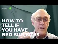 How To Tell If You Have Bed Bug Bites An Entomologist Explains MMPC