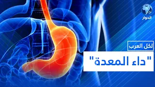 تنعكس التوترات النفسية على المعدة تعرفوا على أساليب الوقاية والعلاج 