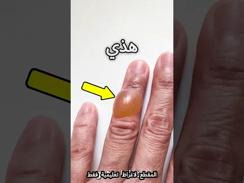 ايش بيصير اذا طلعت لك بالصدفة 😎😎 #shortvideo