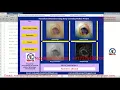 Foot Ulcer Detection Using Image Processing Foot Ulcer Detection Using Deep Learning Matlab Code