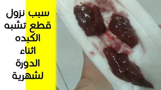 هذا هو سبب نزول قطع لحمية أو دم متجلط في وقت نزول الدورة الشهرية كتل دم متجلطة شبه الكبده 
