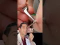 Download Lagu Maggot removed with BACON #doctor #shorts #botfly