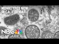California Reports First Suspected Monkeypox Case in Sacramento County